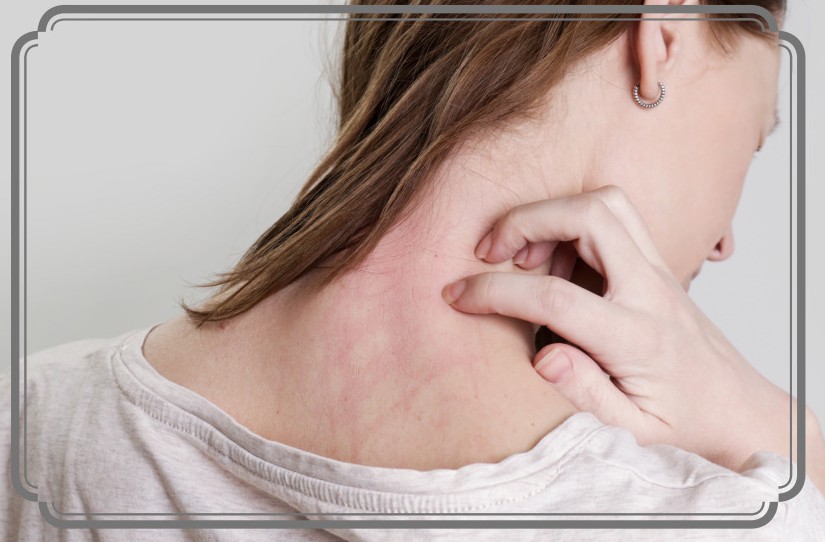 염증에 좋은 음식