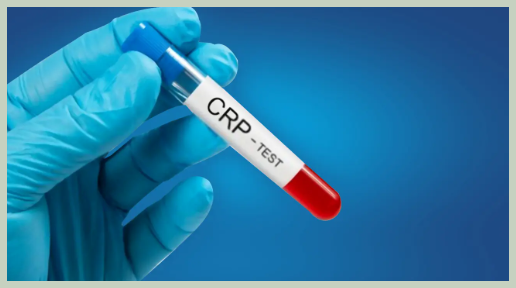 CRP 정상수치