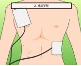 자동심장제세동기