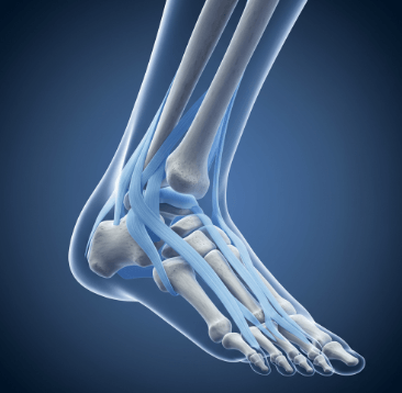 발목 염좌 vs 인대 손상 구분법3