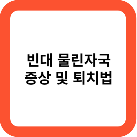빈대