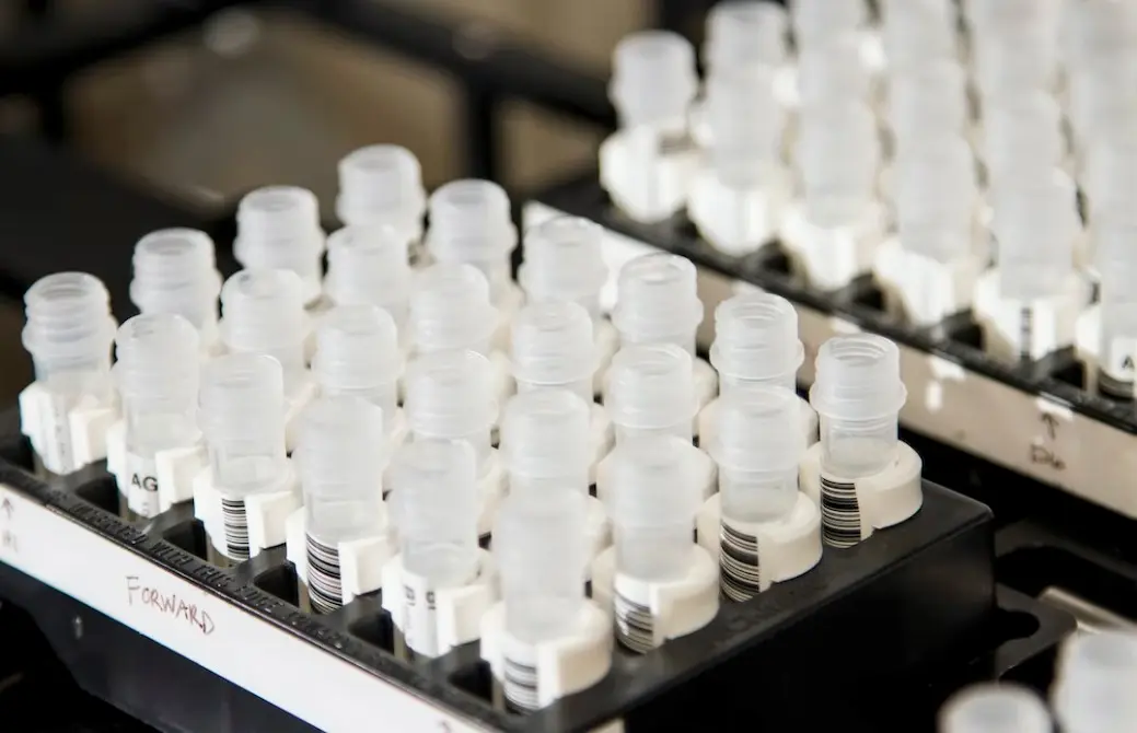 네이처셀 차트 전망 및 알바이오 조인트스템 반려 소식과 신약개발과정 