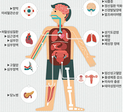 미세먼지