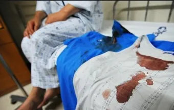 옷에 묻은 실리콘 제거 방법 완벽 가이드 생활 꿀팁_25