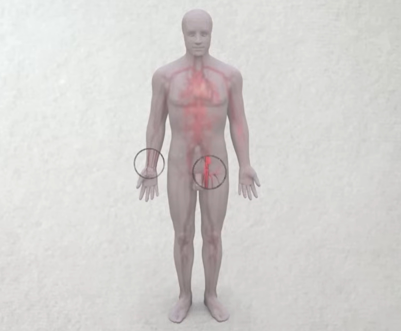 관상동맥 조영술