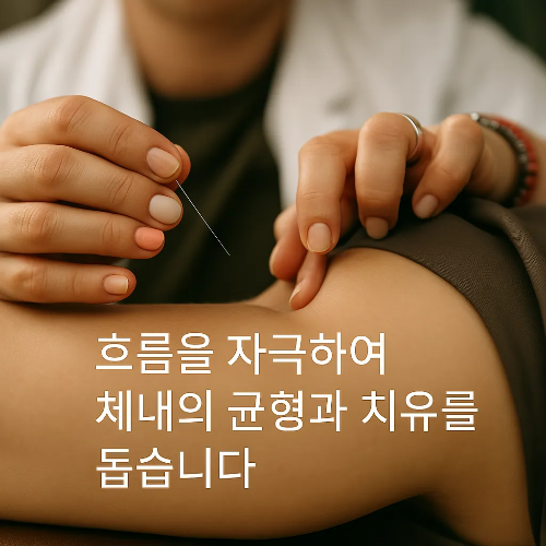 현대 스타일로 정리된 주요 침자리 다이어그램