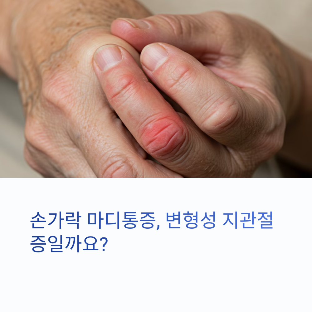 손가락이 아파보이는 사람의 손 사진