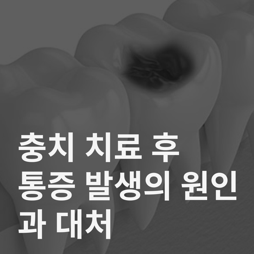 충치 치료 통증