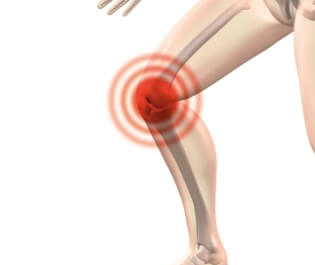 무릎 통증 사진