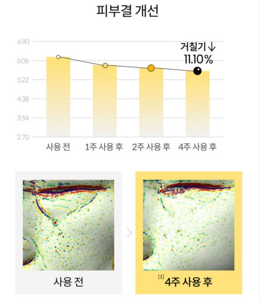 피부결개선