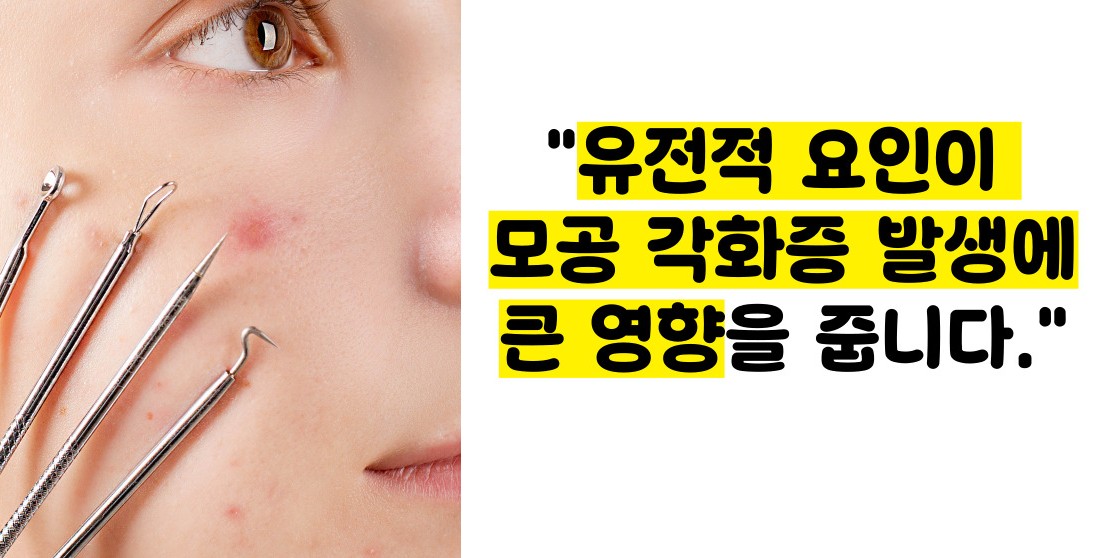 모공 각화증 원인 치료