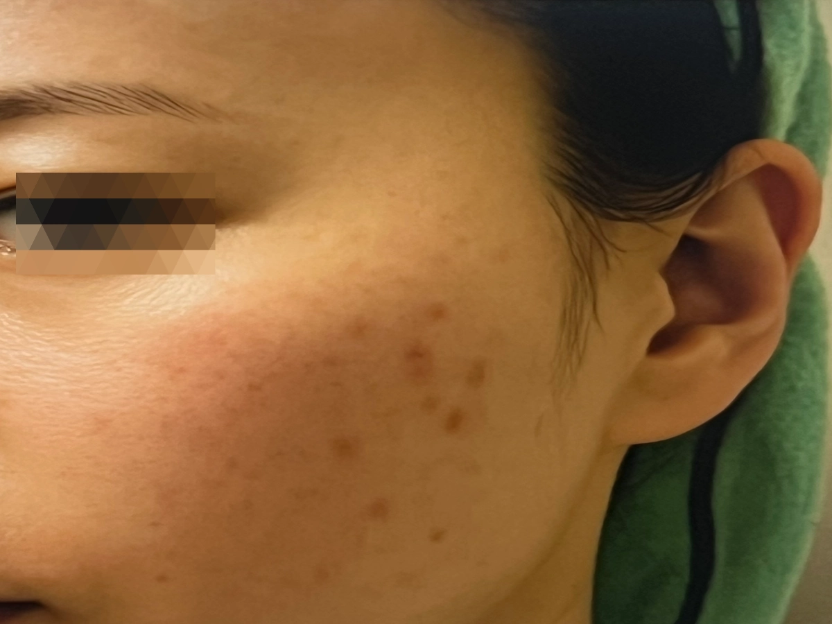 노바덤-펩타이드-세럼-내돈내산-후기-글-작성위해-찍은-셀카