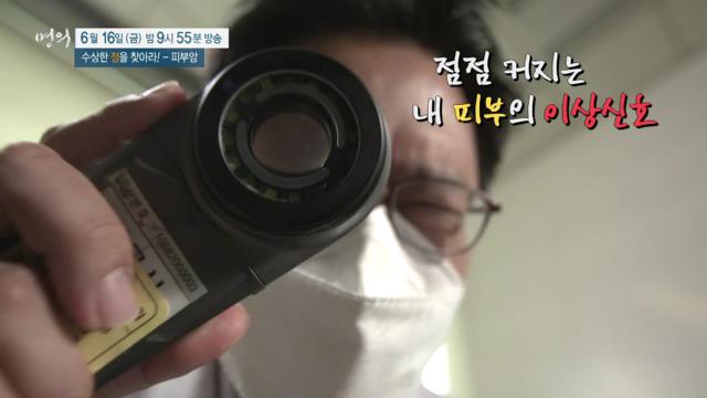명의 수상한 '점'을 찾아라, 피부암, 악성 흑색종, 예방, 치료 방법