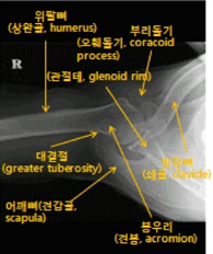 shoulder axial