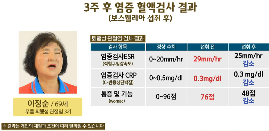 보스웰리아 효능