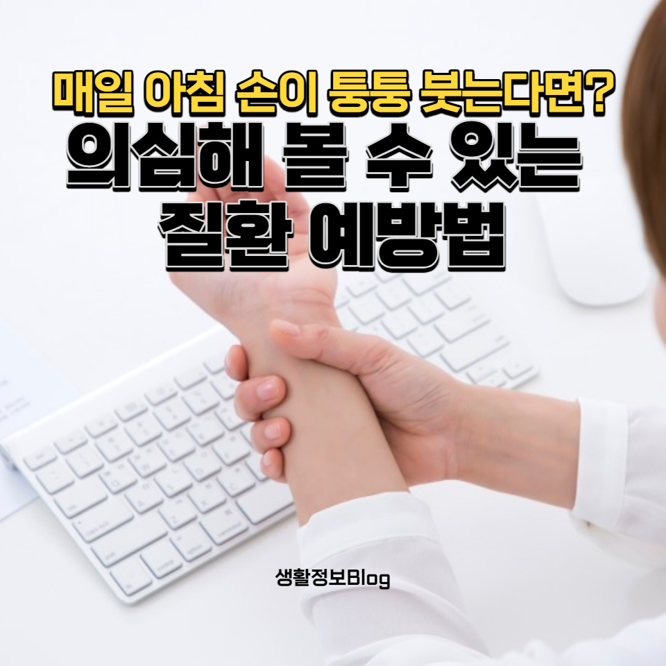 아침 손 붓기의 원인, 관련 질환, 예방 및 관리 방법에 대해 자세히 알아봅니다. 건강한 생활습관과 전문가의 조언을 통해 일상의 불편함을 해결해 보세요.