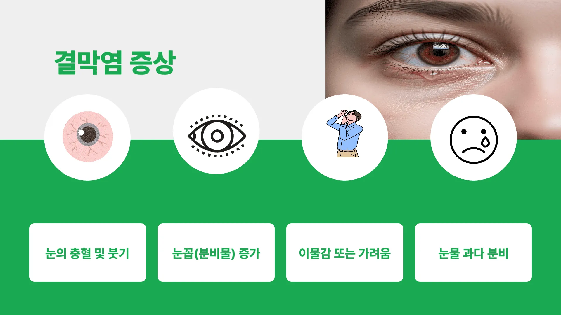 결막염의 원인과 주요 증상
