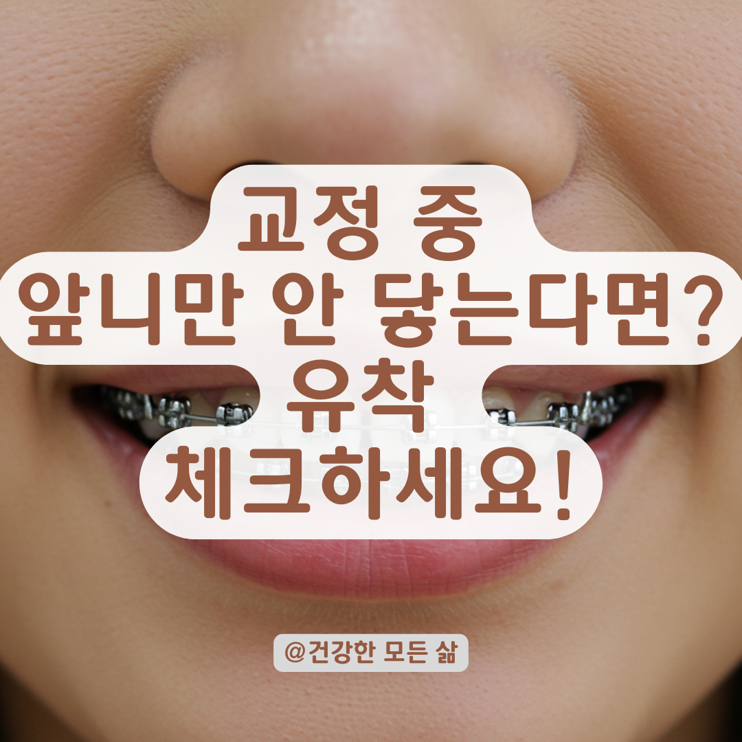 교정기 착용해도 앞니만 안 맞는 느낌, 단순 오차일까 유착일까? 체크 포인트 정리.