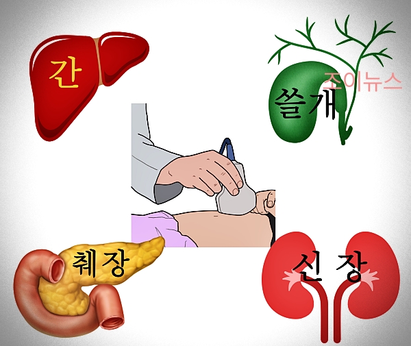 복부 초음파 검사를 통해 알 수 있는 질병들