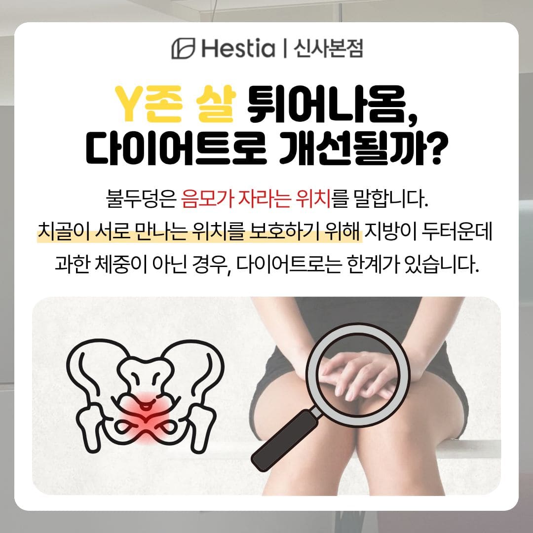 Y존 살 튀어나옴, 다이어트로 개선될까?