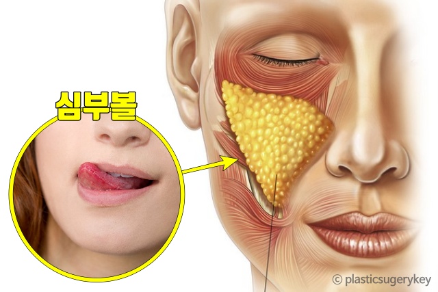 심부볼 살찐 혀 깨물었을때 기도가 막히는 수면무호흡증, 내장지방 빼는법, 다이어트 건강 팁줌 매일꿀정보