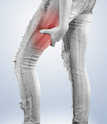 고관절 통증 증상 원인 치료법 스트레칭 운동 총정리