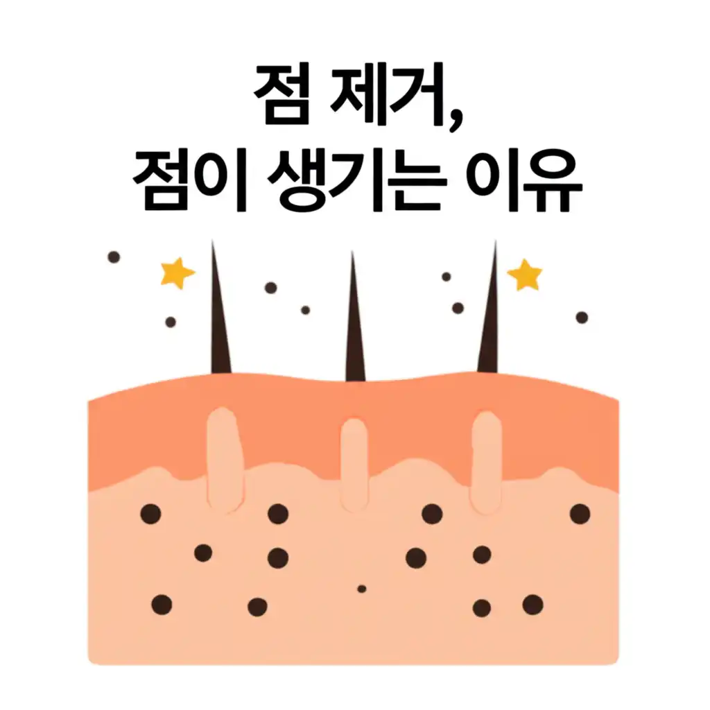 점이생기는이유_common-mistakes