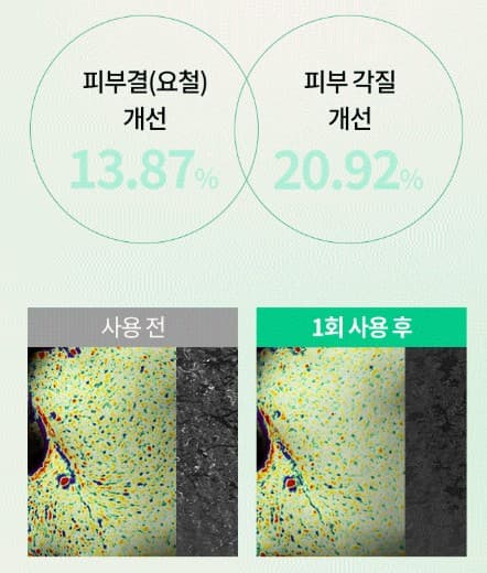 비렌느스팟엑스 성분