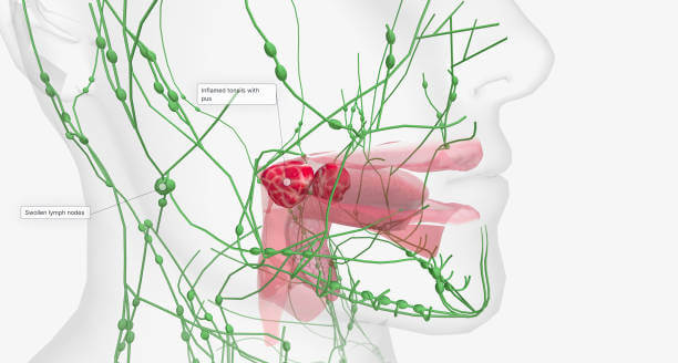 목젖 부었을때, 목젖 늘어짐이 있을 때 증상들이 있습니다. 날씨가 추워지거나 환절기에 많은 사람들이 감기에 걸리고 콧물, 기침, 인후염 때문에 인후통이 있습니다. 이렇게 추운 날씨에는 면역력이 떨어지기 쉬우니 건강관리에 더욱 신경을 쓰셔야 합니다. 그 중에도 목젖이 부었거나 늘어짐이 있는 원인과 증상을 참고하세요.