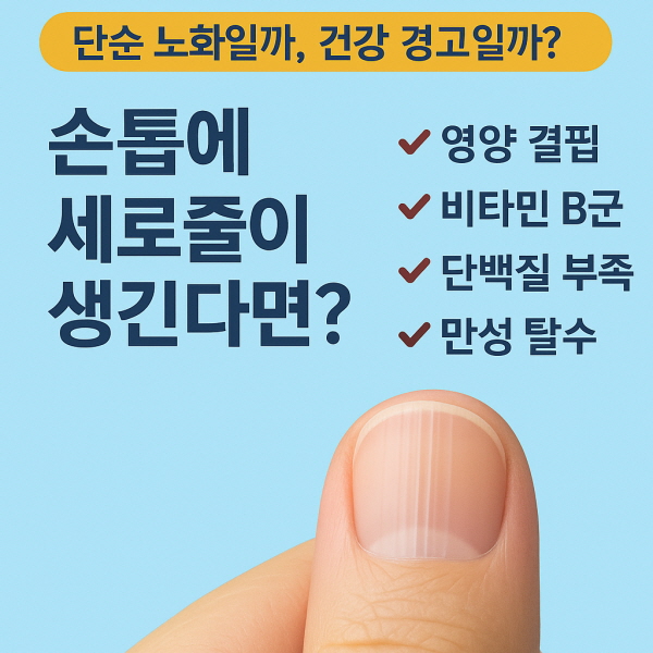손톱에 세로줄이 생긴다면?/gpt