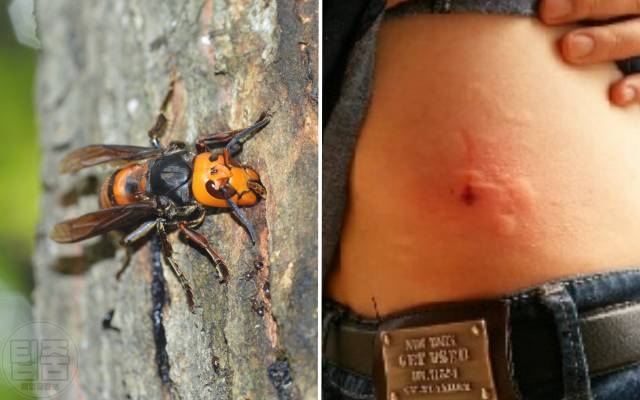 장수말벌 물린자국 구별,건강