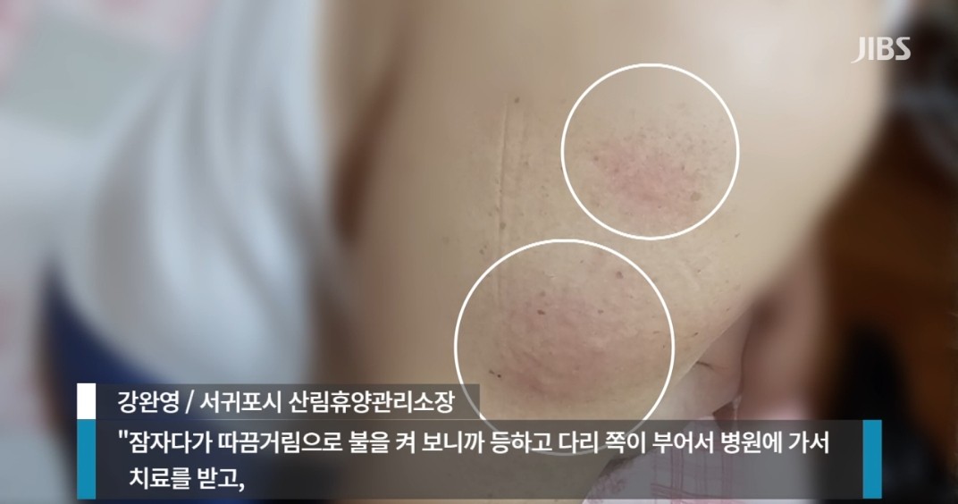 JIBS 빈대 발견 제주도 서귀포 자연휴양림 숙박 시설 어디