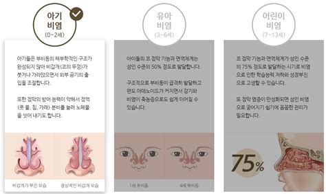비염 치료