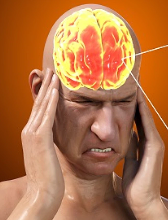 뇌졸중 전조증상