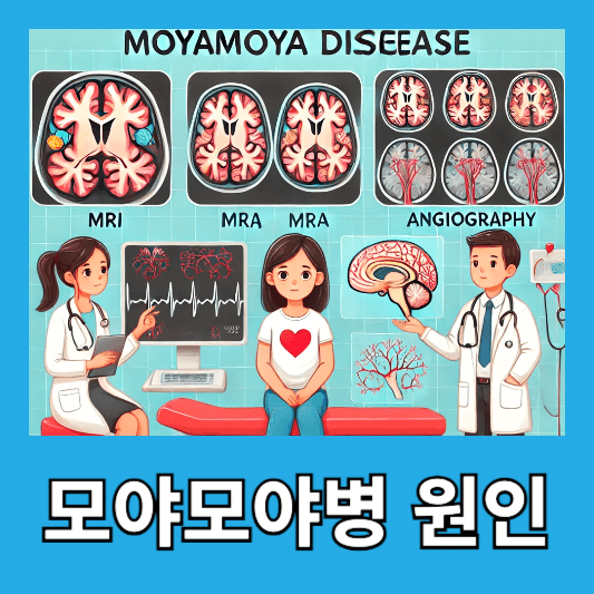 모야모야병 원인