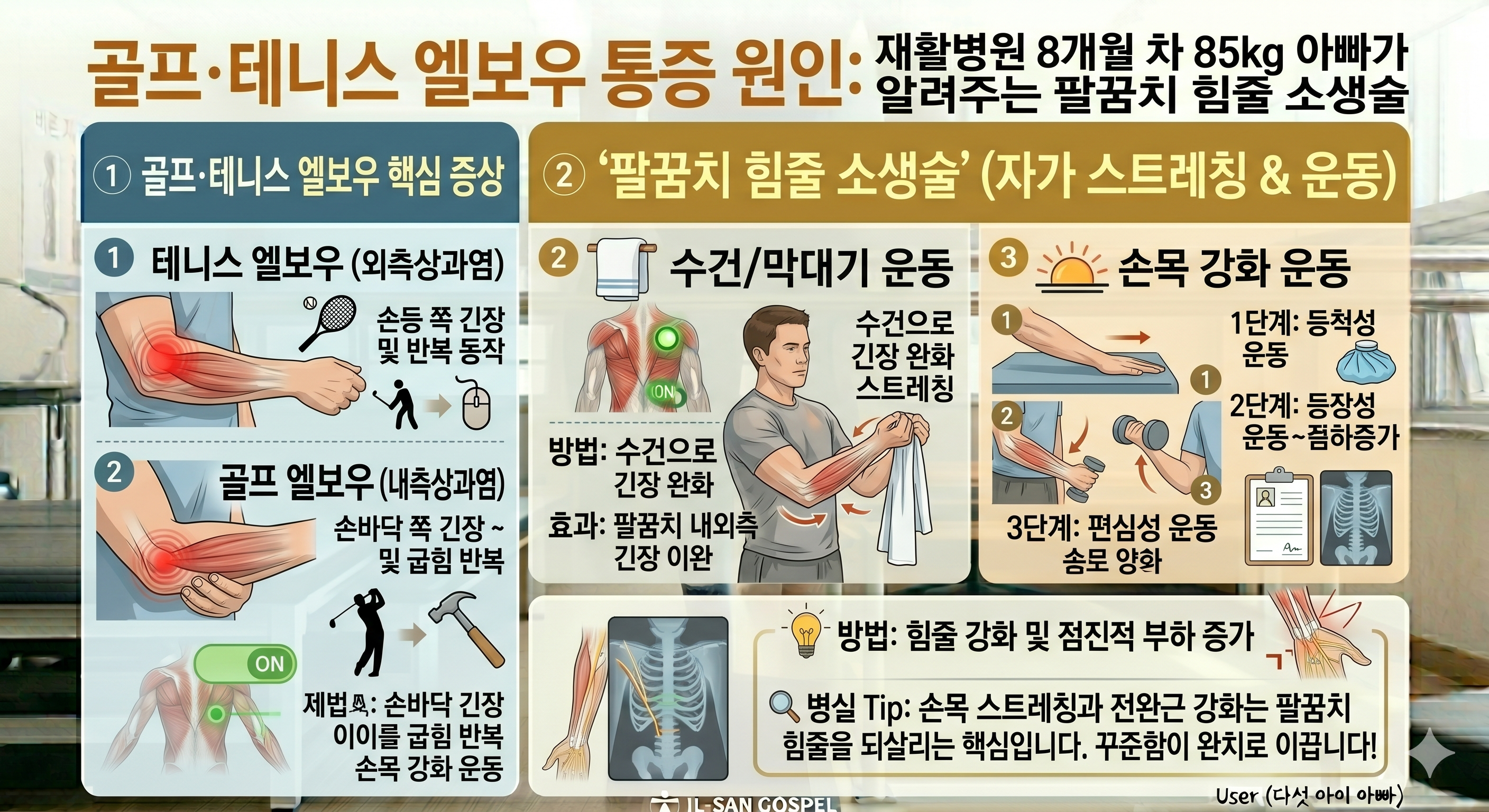 골프&middot;테니스 엘보우 통증 원인: 재활병원 8개월 차 85kg 아빠가 알려주는 팔꿈치 힘줄 소생술