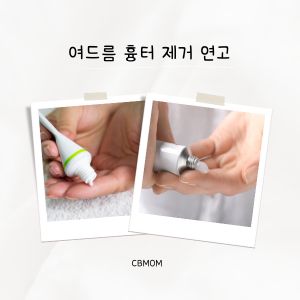 여드름 흉터 제거 연고