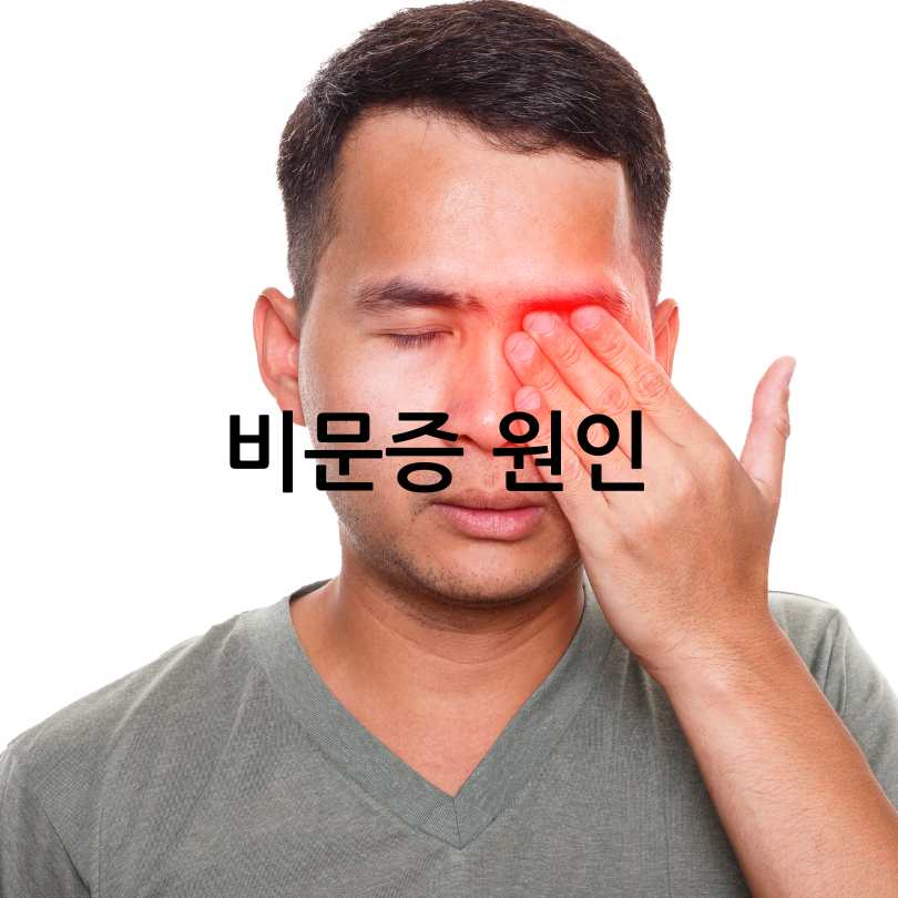 비문증(날파리증)
