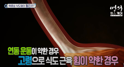 역류성 식도염 증상