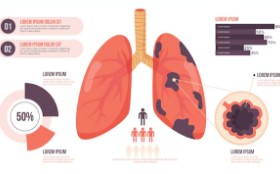 기관지염-증상-2
