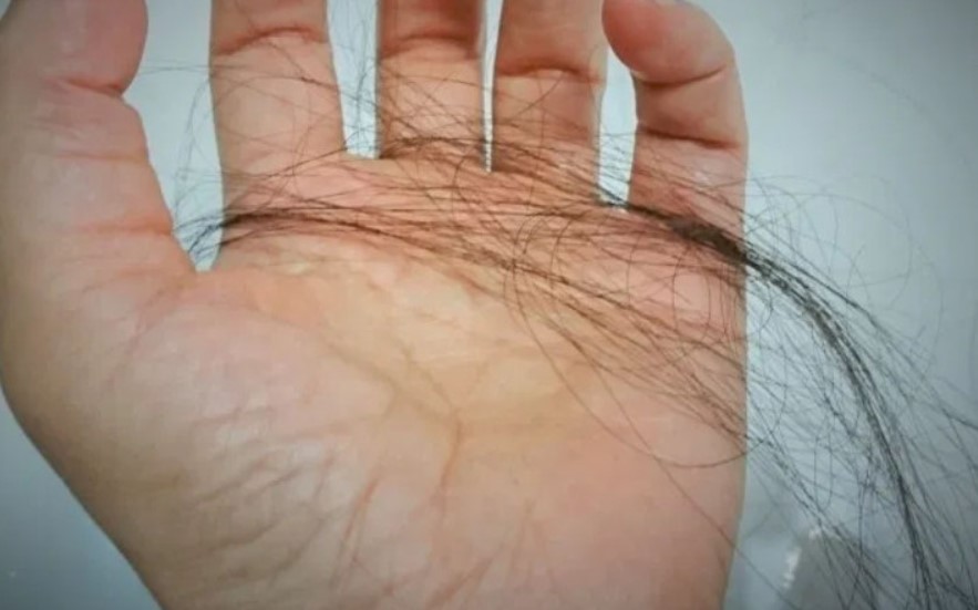 꿈해몽-머리카락-빠지는-꿈-꿈해몽-해드립니다