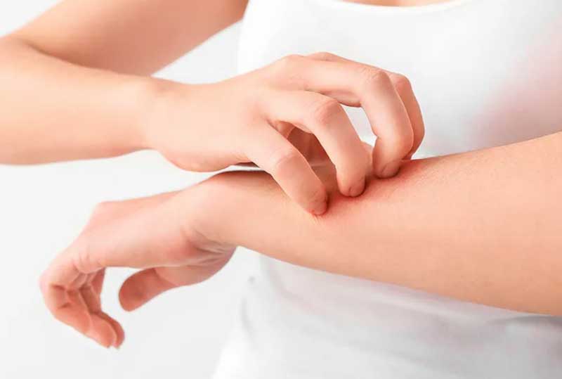 프로폴리스 면역력 밸런스 정돈 효과