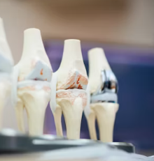 류마티스 관절염 초기증상 치료 원인 예방법