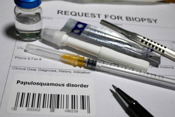 장미색 비강진 원인&amp;#44; 치료&amp;#44; 재발 등에 대해 알아봤습니다. 장미색 비강진은 pityriasis rosea이라고 불리는데요. 어떤 증상과 원인 치료가 있는지 꼼꼼히 읽어보세요! 