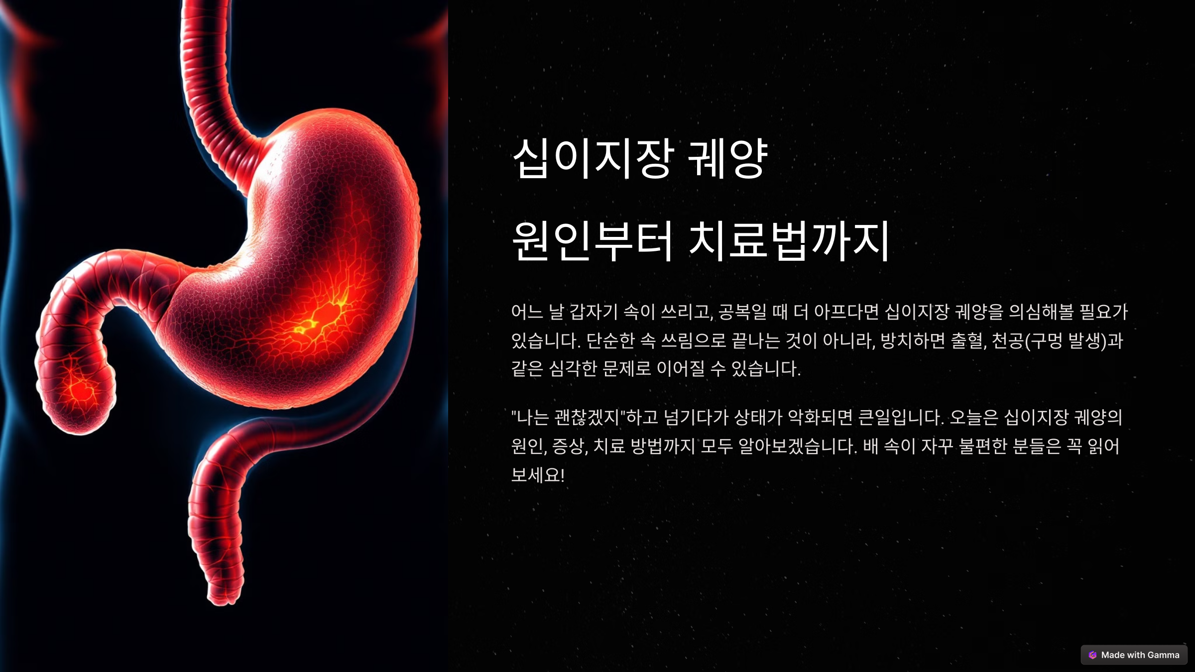 십이지장 궤양 증상? 원인부터 치료법까지 완전 정리!