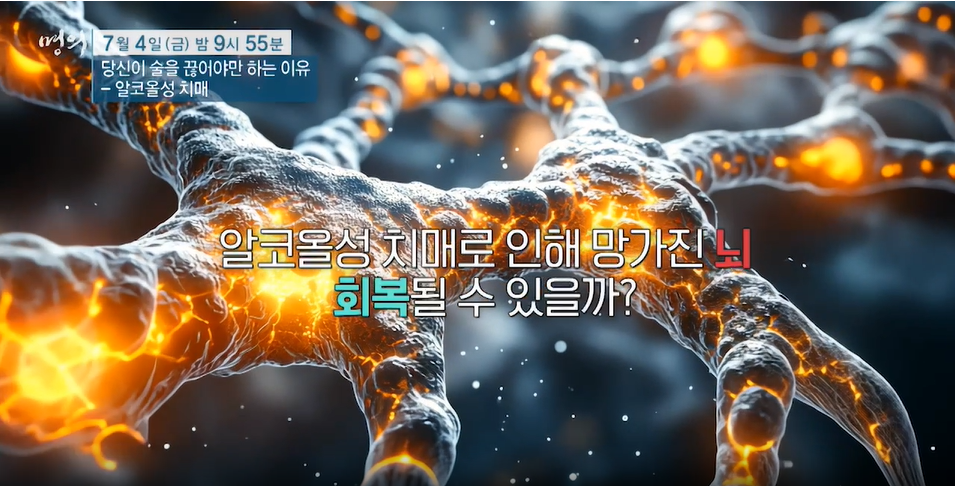 명의/알코올성 치매-당신이 술을 끊어야 하는 이유