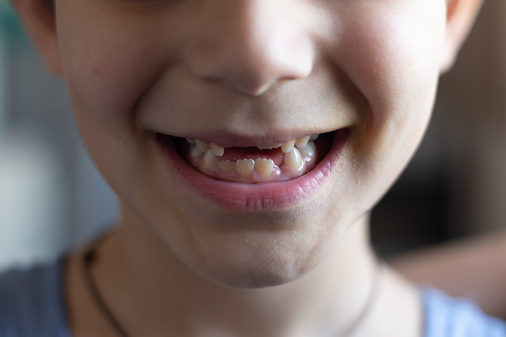 이빨 빠지는 꿈