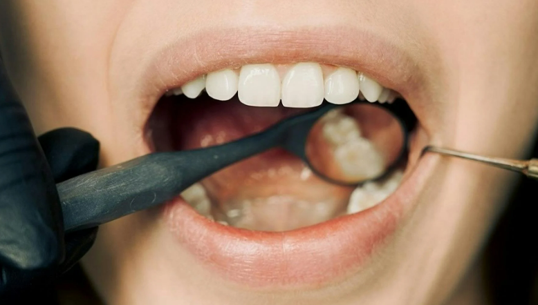 이빨빠지는꿈해몽