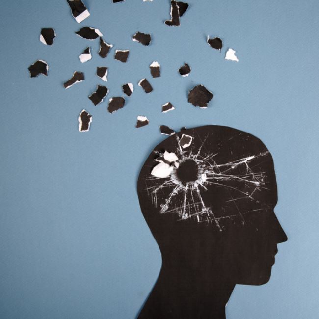 파킨슨병-초기증상-치료방법