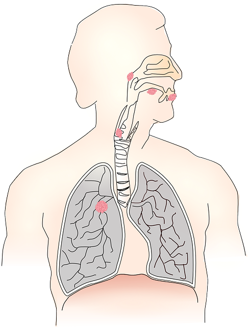 폐암관련 이미지 자료